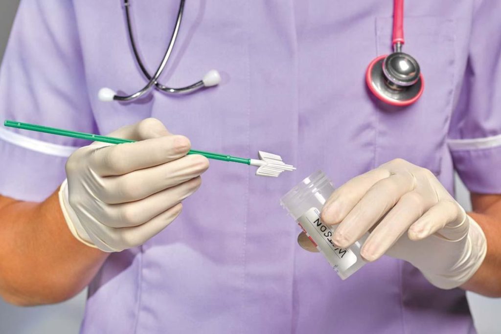 آزمایش پاپ اسمیر