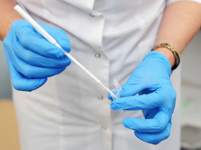 تست پاپ اسمیر