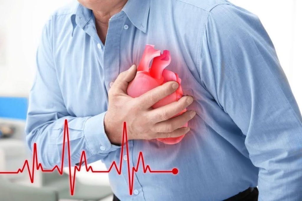 سکته قلبی: راهنمای جامع شناخت علائم، پیشگیری و درمان فوری