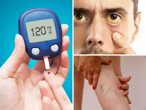 علائم دیابت - نشانه های دیابت