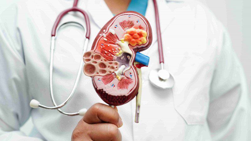 علت نفروپاتی دیابتی