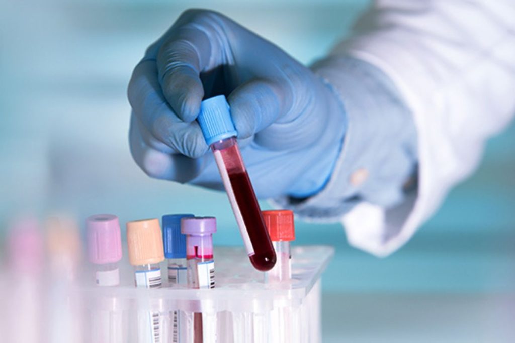 راهنمای کامل آزمایش A1c: از نحوه انجام تا تفسیر نتایج