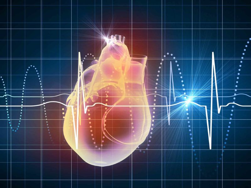 آریتمی چگونه تشخیص داده می‌شود؟