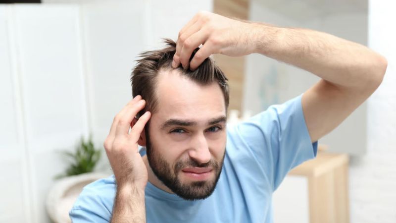 علائم ریزش مو در اثر کم‌کاری تیروئید چیست؟