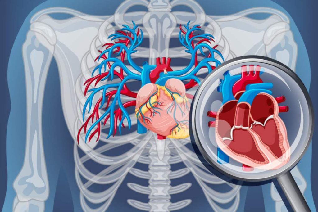 آنژیوگرافی قلبی