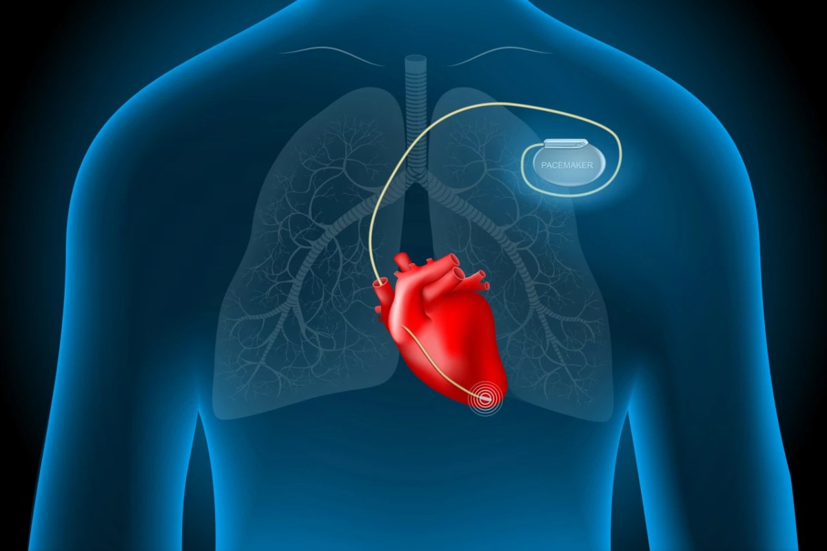 عمر کسانی که باتری قلب دارند چقدر است؟