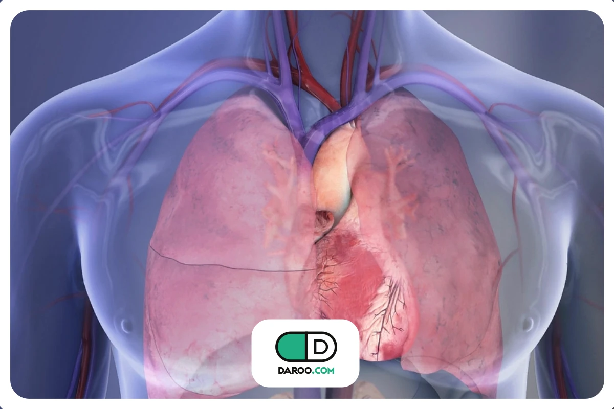 خطرات و عوارض سکته قلبی؛ عوارض کوتاه‌مدت و بلندمدت سکته