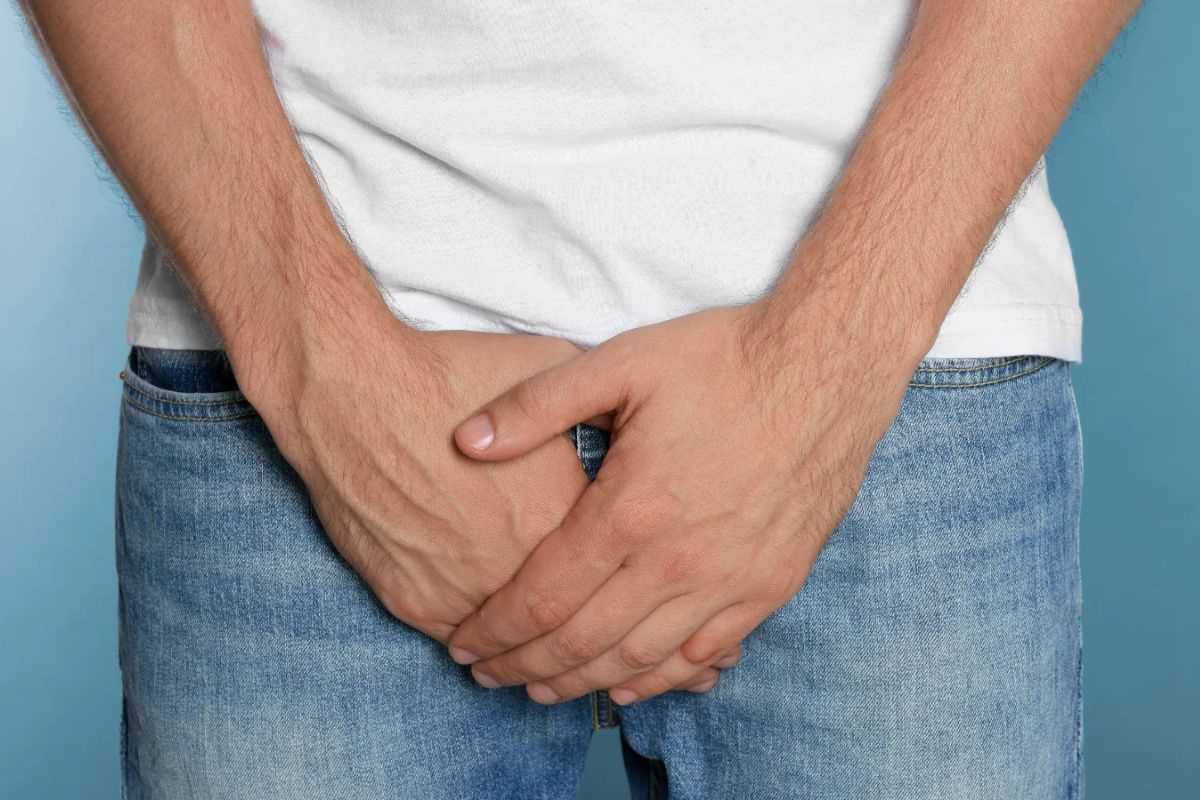 درمان زگیل تناسلی مردان؛ بررسی بهترین روشهای درمانی