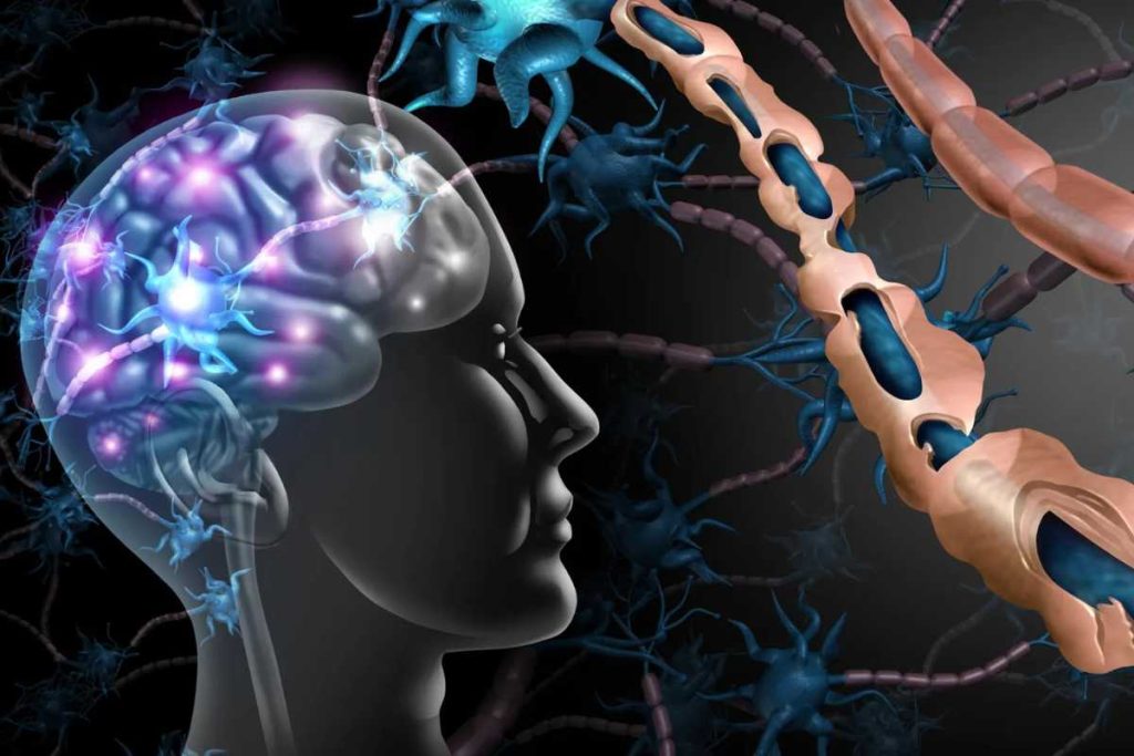 درمانی جدید برای ام‌اس کشف شد!