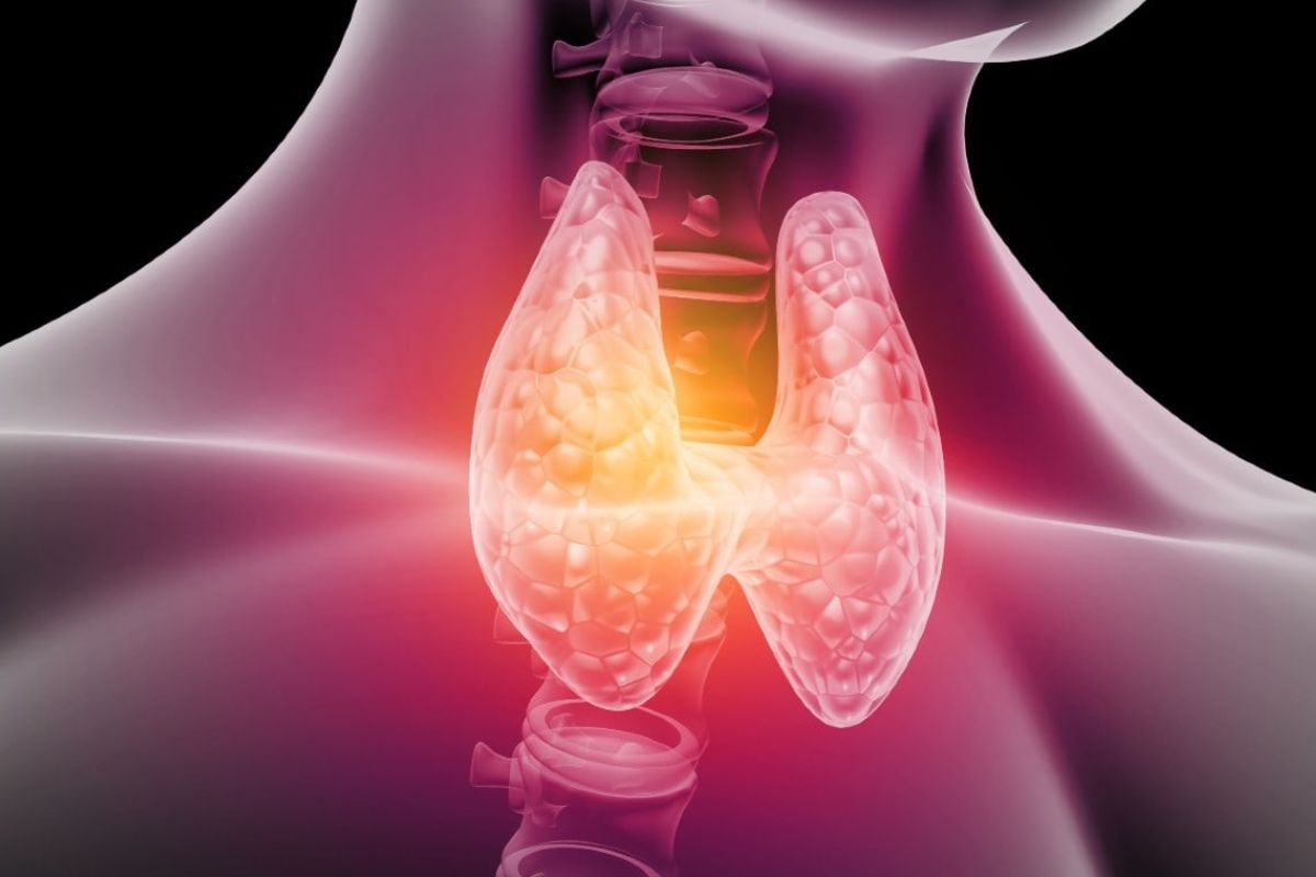 طوفان تیروئیدی