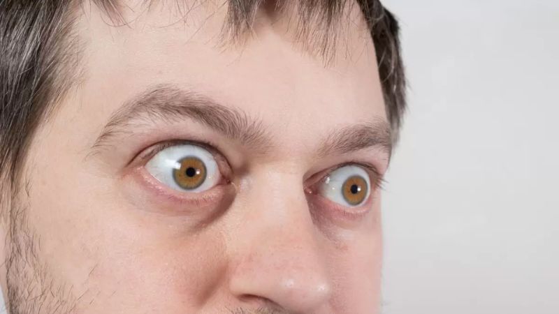 زندگی با بیماری گریوز