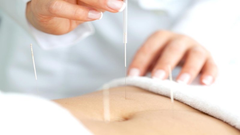 طب سوزنی به عنوان درمان خانگی زخم معده