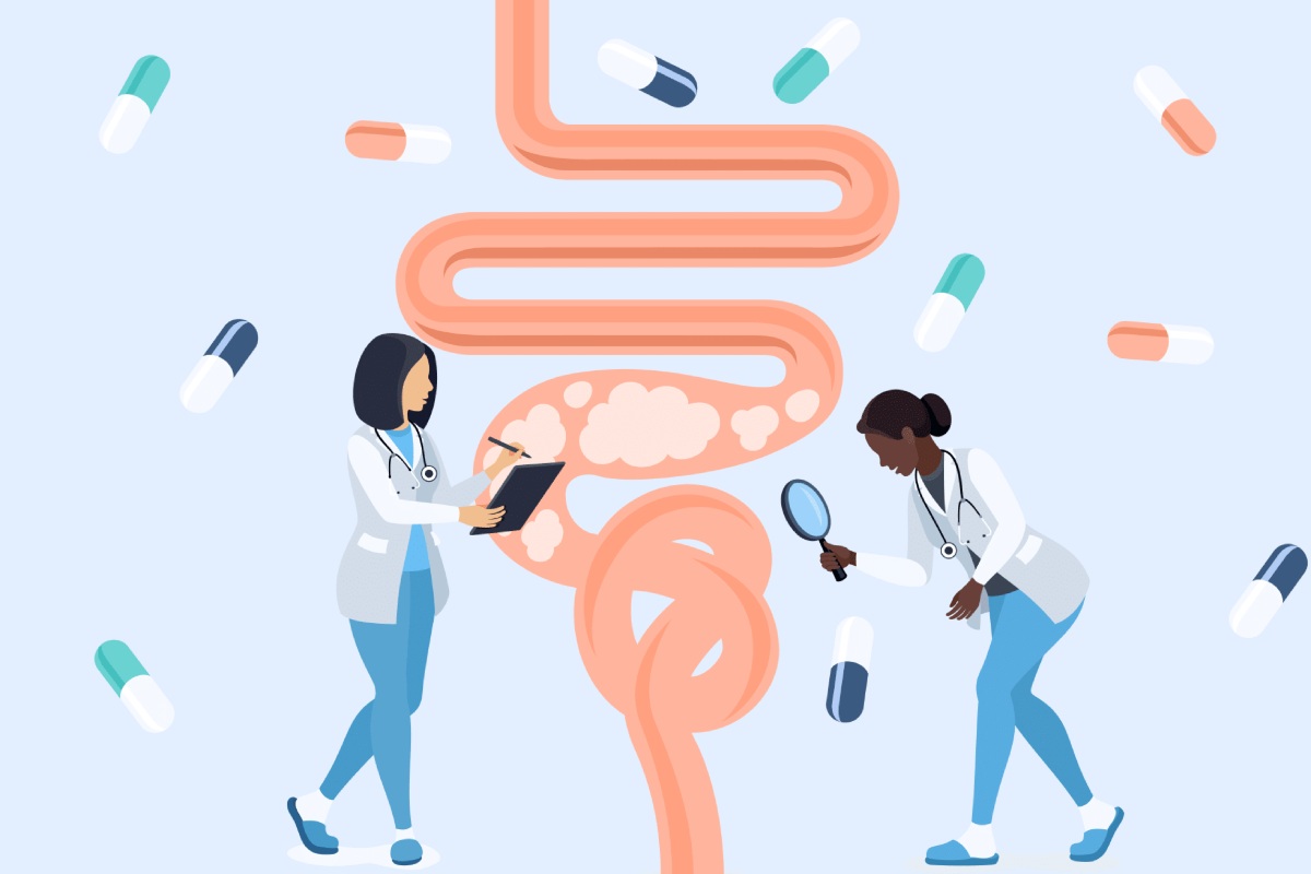 بهترین قرص ها برای سندروم روده تحریک پذیر