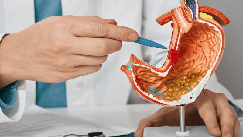 درمان علائم زخم معده با دارو درمان علائم زخم معده با دارو