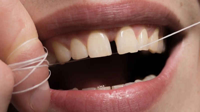 روش جلوگیری از بوی بد دهان ناشی از معده