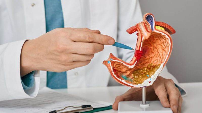 خطرات و عوارض جراحی زخم معده خطرات و عوارض جراحی زخم معده