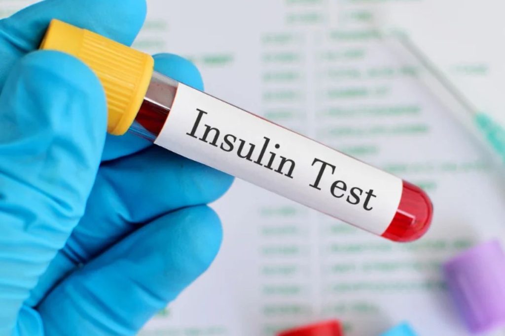 تست انسولین و نحوه تفسیر آن