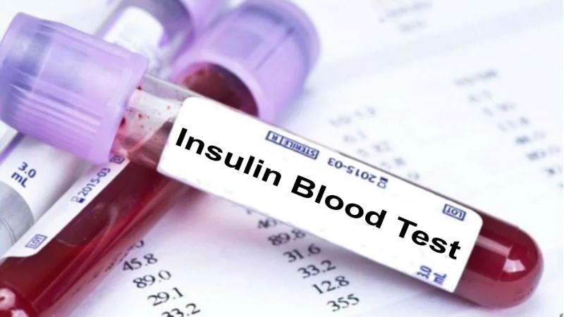 نتایج آزمایش انسولین