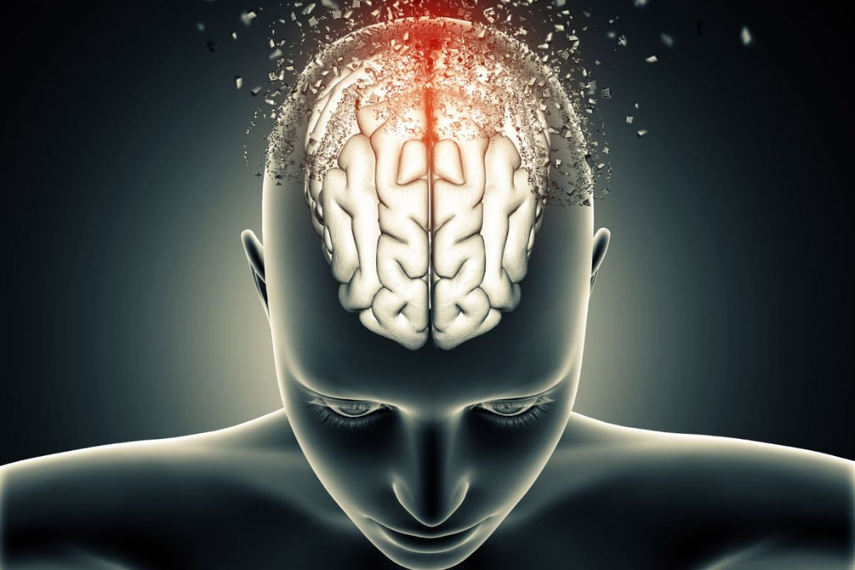 اختلال اضطراب عصبی