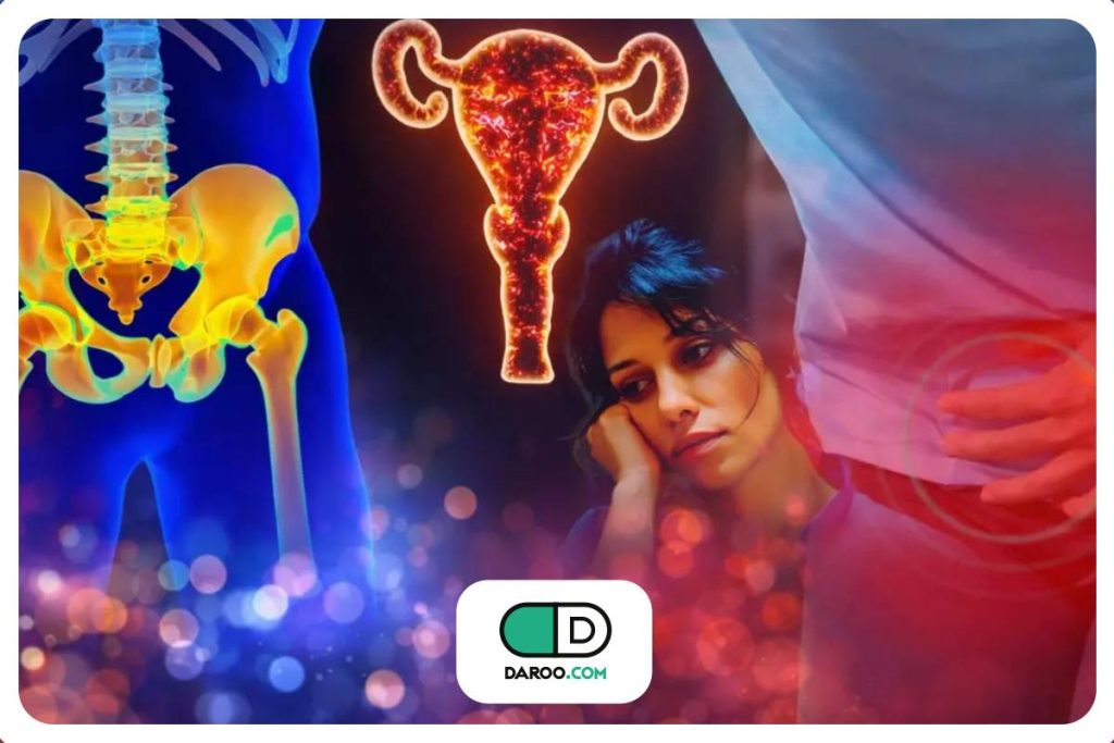 ٧ تا ١٠ سال تأخیر در تشخیص بیماری زنانه آندومتریوز