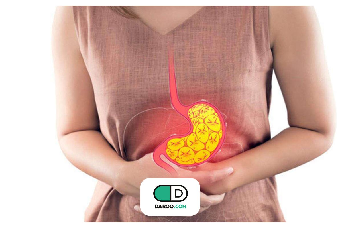 علت ترش کردن معده و راه‌های درمان آن