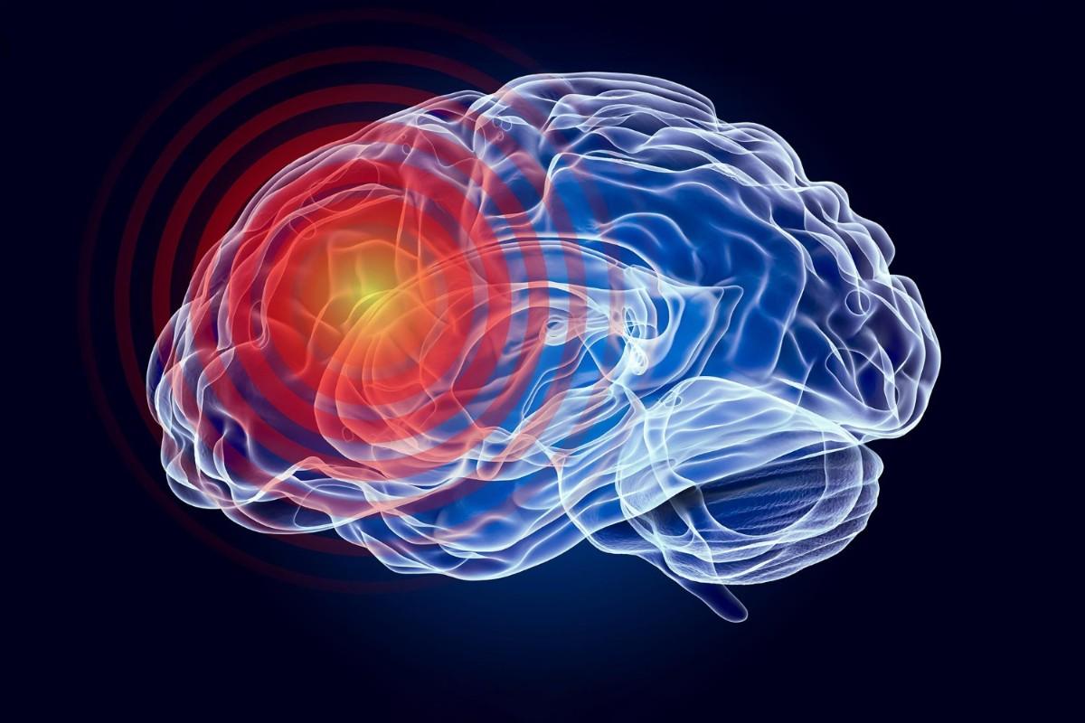 کمبود مواد مغذی پنهان در مغز میتواند باعث اضطراب شود!