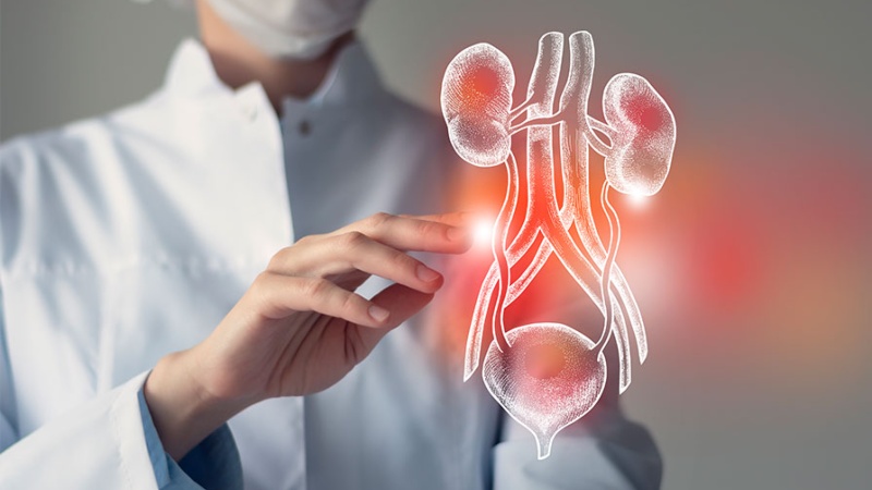 عفونت ادراری 