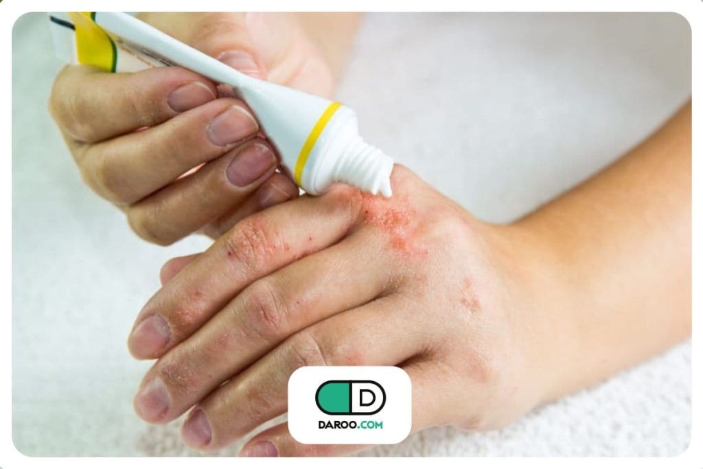 بهترین دارو برای خارش بدن