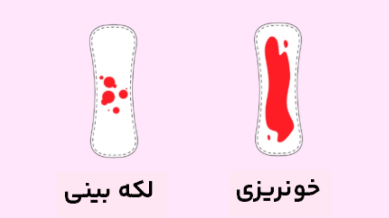 لکه‌بینی در دوران بارداری