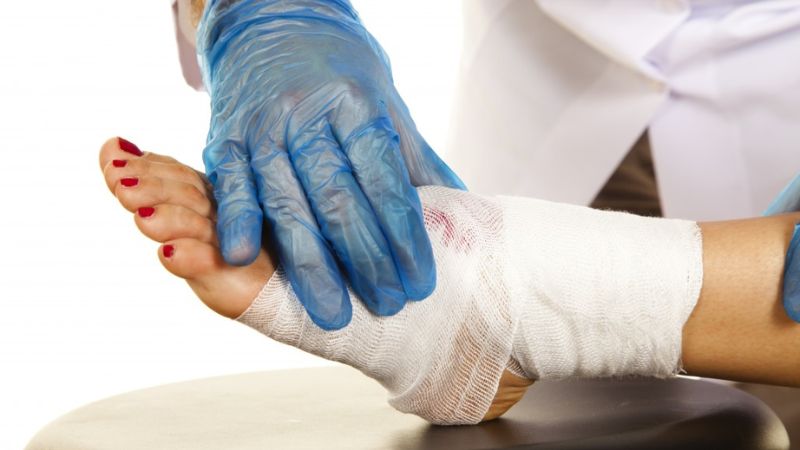 علائم هشداردهنده قبل از قطع عضو در بیماران دیابتی