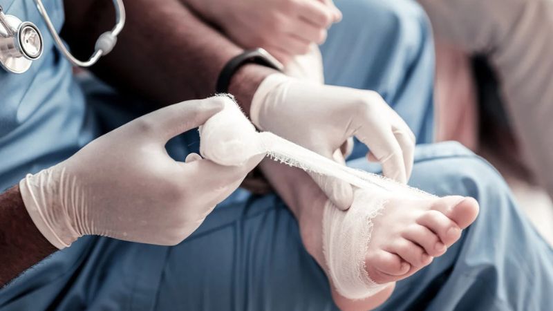 روشهای درمان زخمهای پای دیابتی روشهای درمان زخمهای پای دیابتی