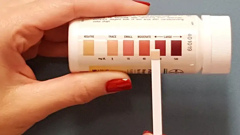 نحوه انجام آزمایش خانگی دیابت با نوار تست ادرار