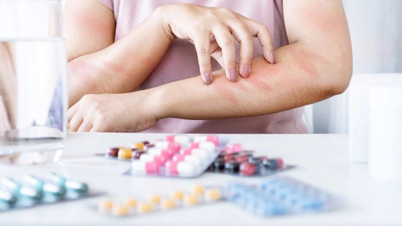 نحوه تشخیص سندرم دِرِس نحوه تشخیص سندرم دِرِس