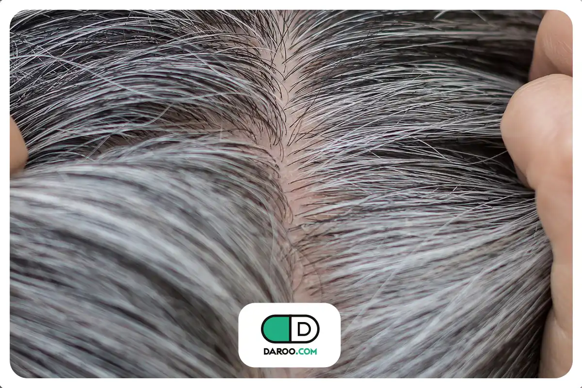 سفید شدن موها خبری خوب برای سلامت