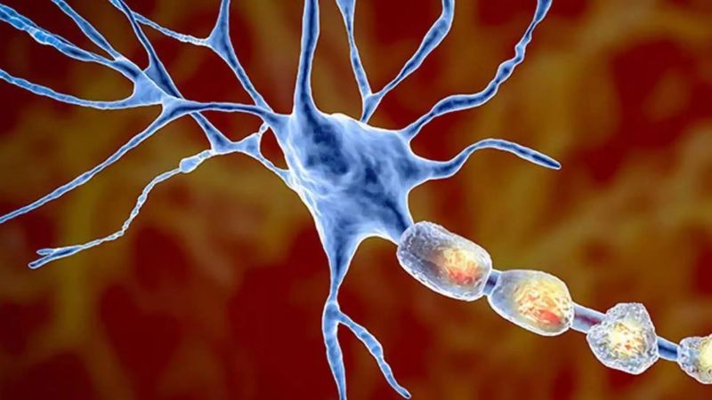 شیوه تشخیص و درمان ام اس با هوش مصنوعی