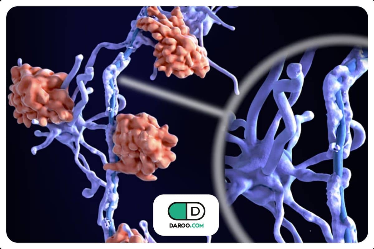 کشف زیرنوعهای جدید اماس با کمک هوش مصنوعی