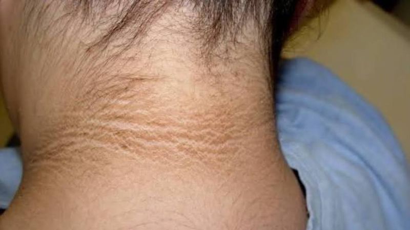 علائم پوستی در کودکان