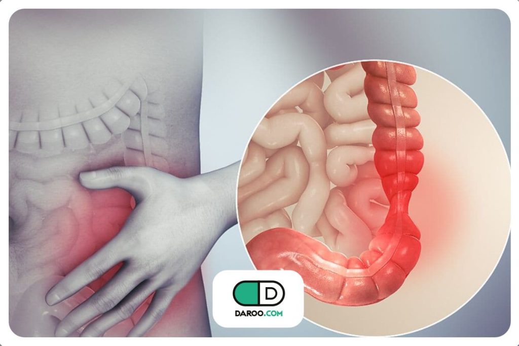 محققان به تصویر آنچه در شروع بیماری در روده اتفاق می‌افتد دست یافتند!
