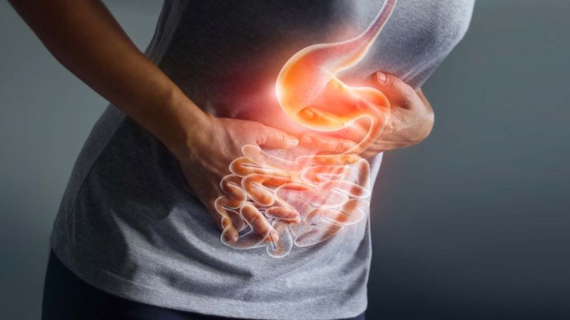 روش‌های جلوگیری از خونریزی معده