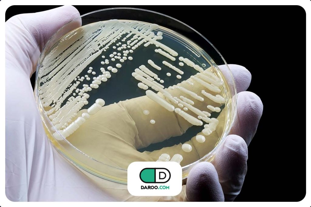 کاندیدا اوریس چیست