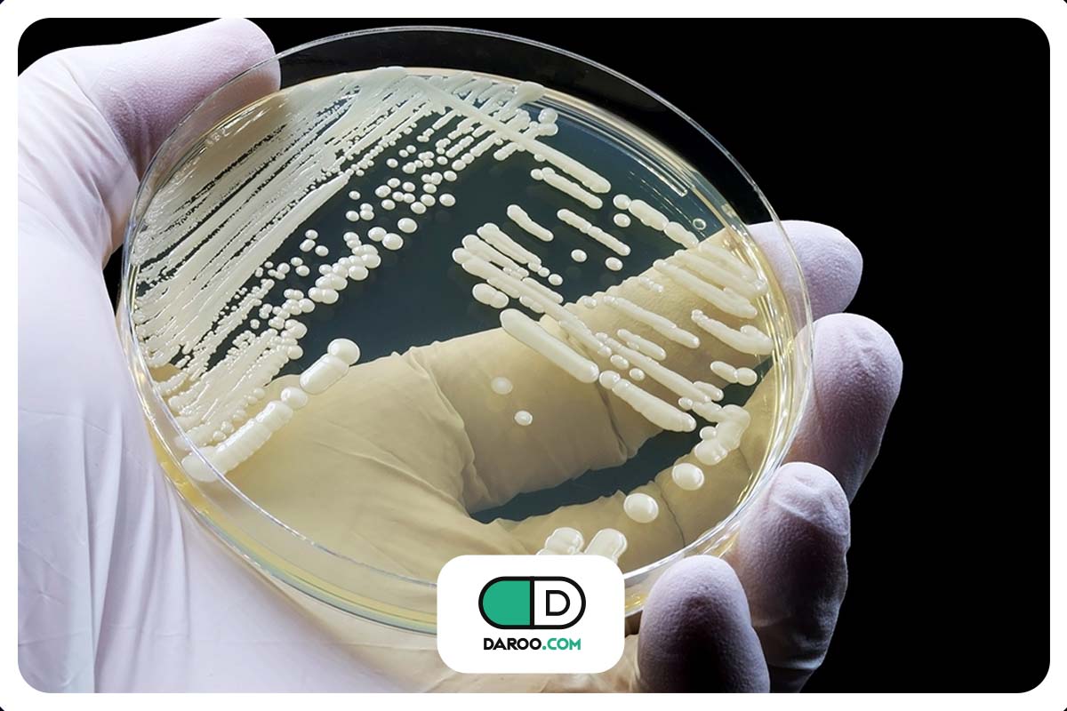 کاندیدا اوریس چیست