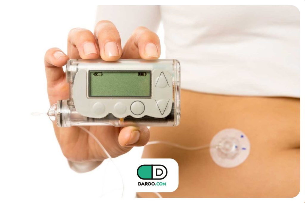 پمپ انسولین و نحوه کارکرد آن