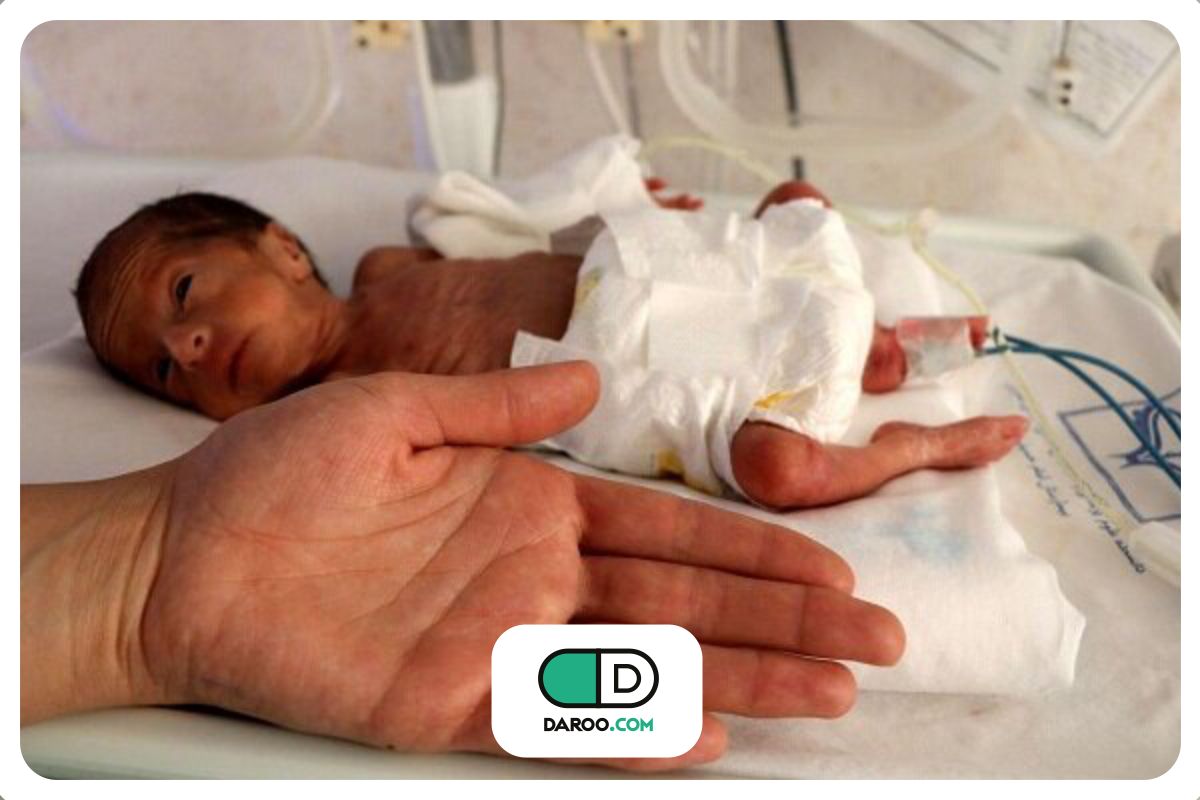 نوزاد نارس ۷۰۰ گرمی پس از ۴۸ روز ترخیص شد