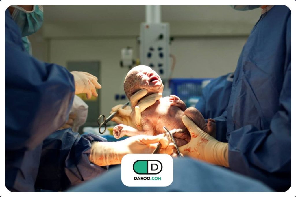 سزارین در ایران کم نشده است!