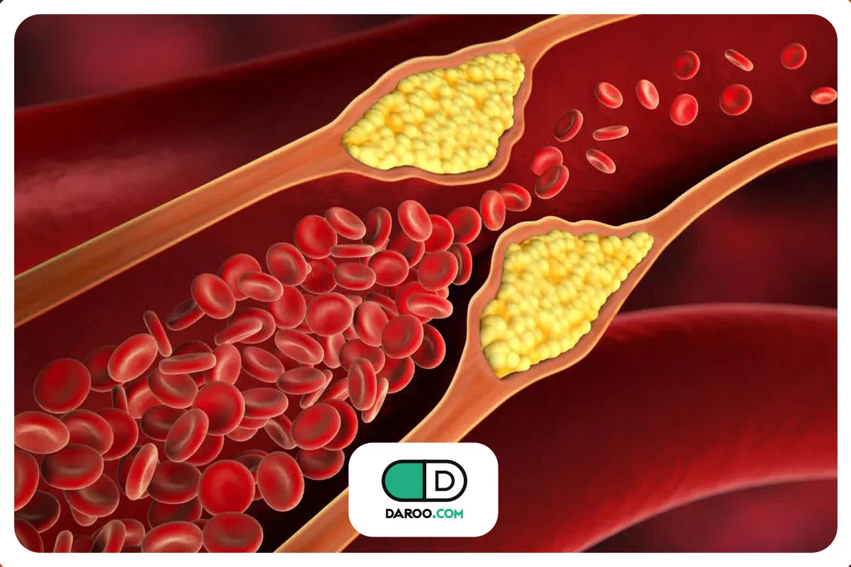 ارتباط دیابت و چربی خون چیست؟