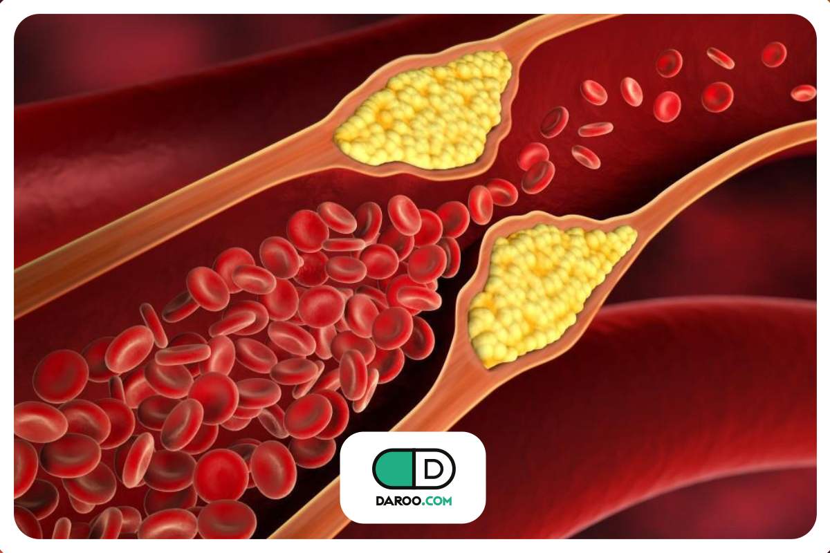 خطر پنهان بیماری قلبی، حتی با آزمایش کلسترول طبیعی