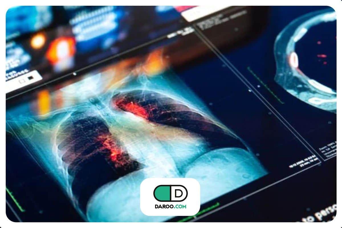 بحران قریبالوقوع و تهدید جان ۱۸ میلیون نفر در هر سال