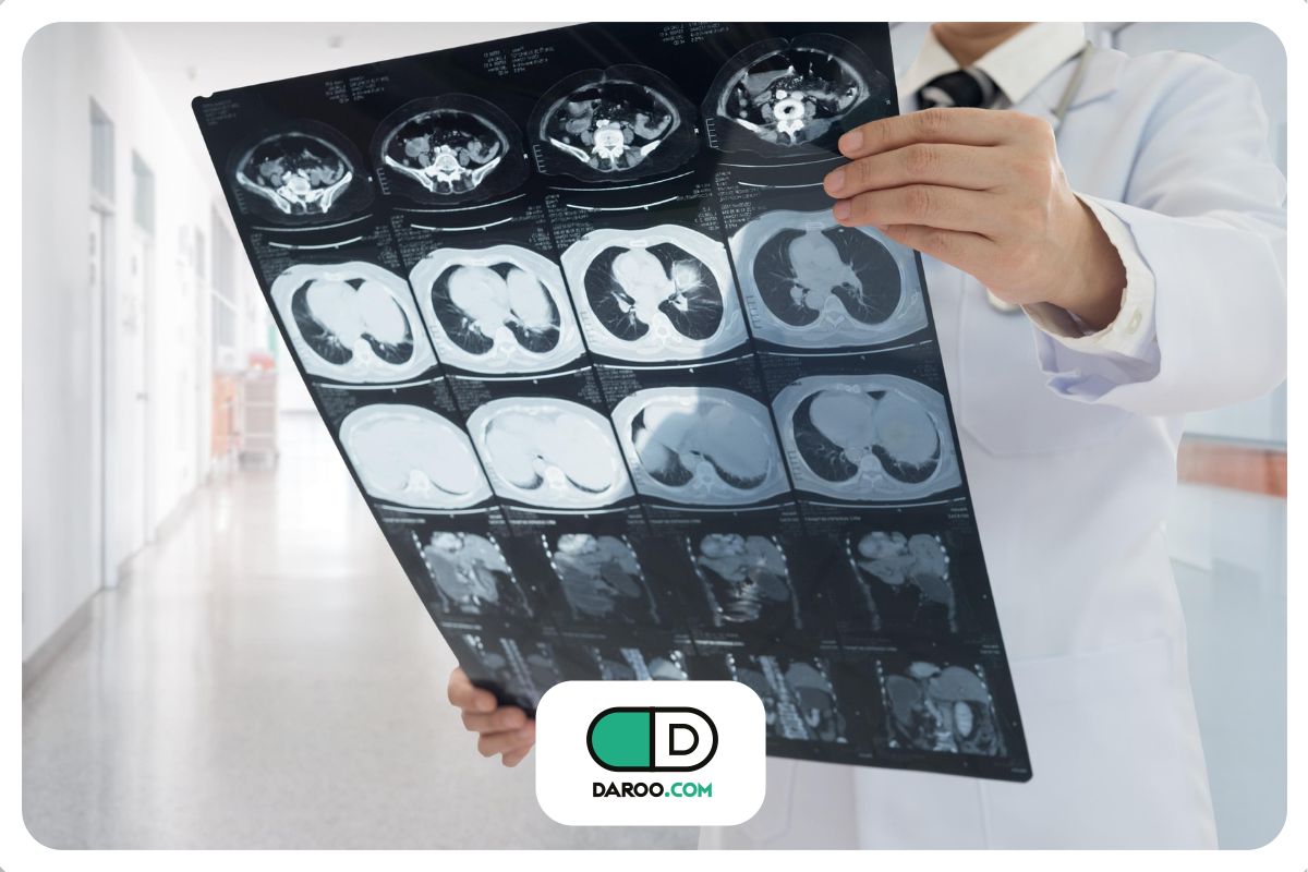 امارآی کبد؛ دقیقترین روش برای شناسایی زودهنگام سرطان کبد