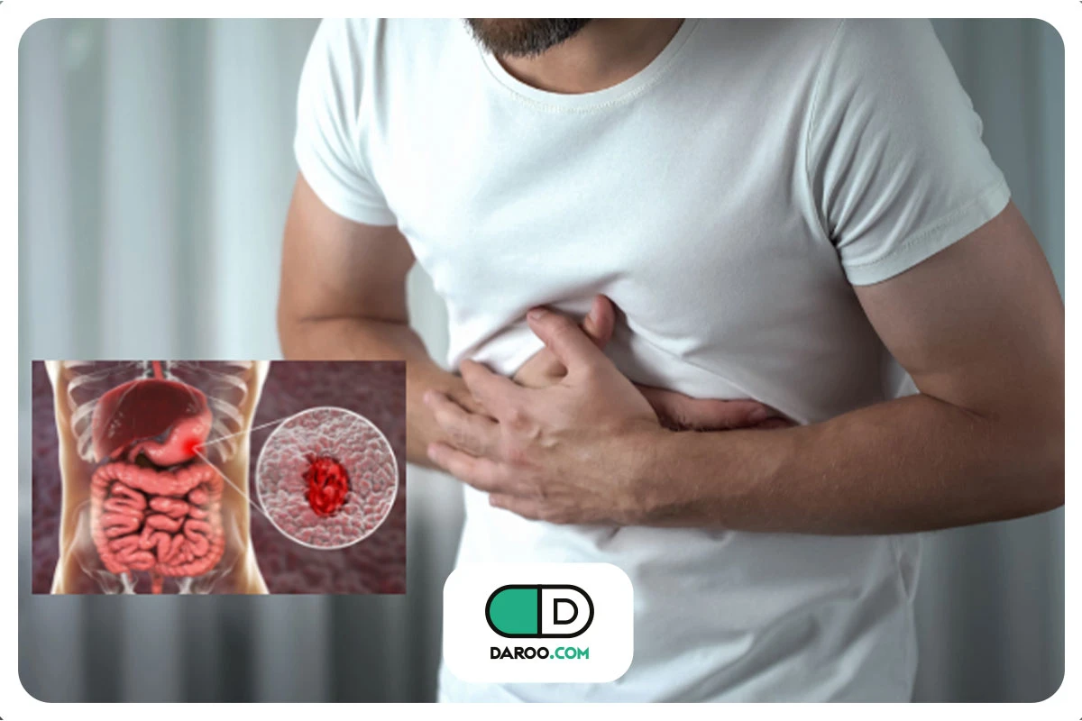 علائم زخم معده عصبی چیست؟ + راه‌های درمان