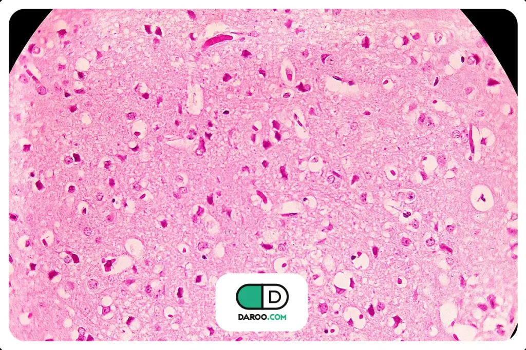 ویروس ونزوئلایی